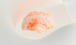 Очереди за антибиотиками и вопросы к властям: в Кенте идентифицирован штамм менингита MenB | London Cult.